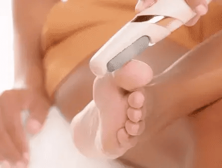 Removedor de Callos Eléctrico V2 | Pies Suaves al Instante